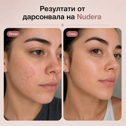 Nudera Дарсонвал