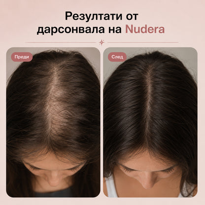 Nudera Дарсонвал
